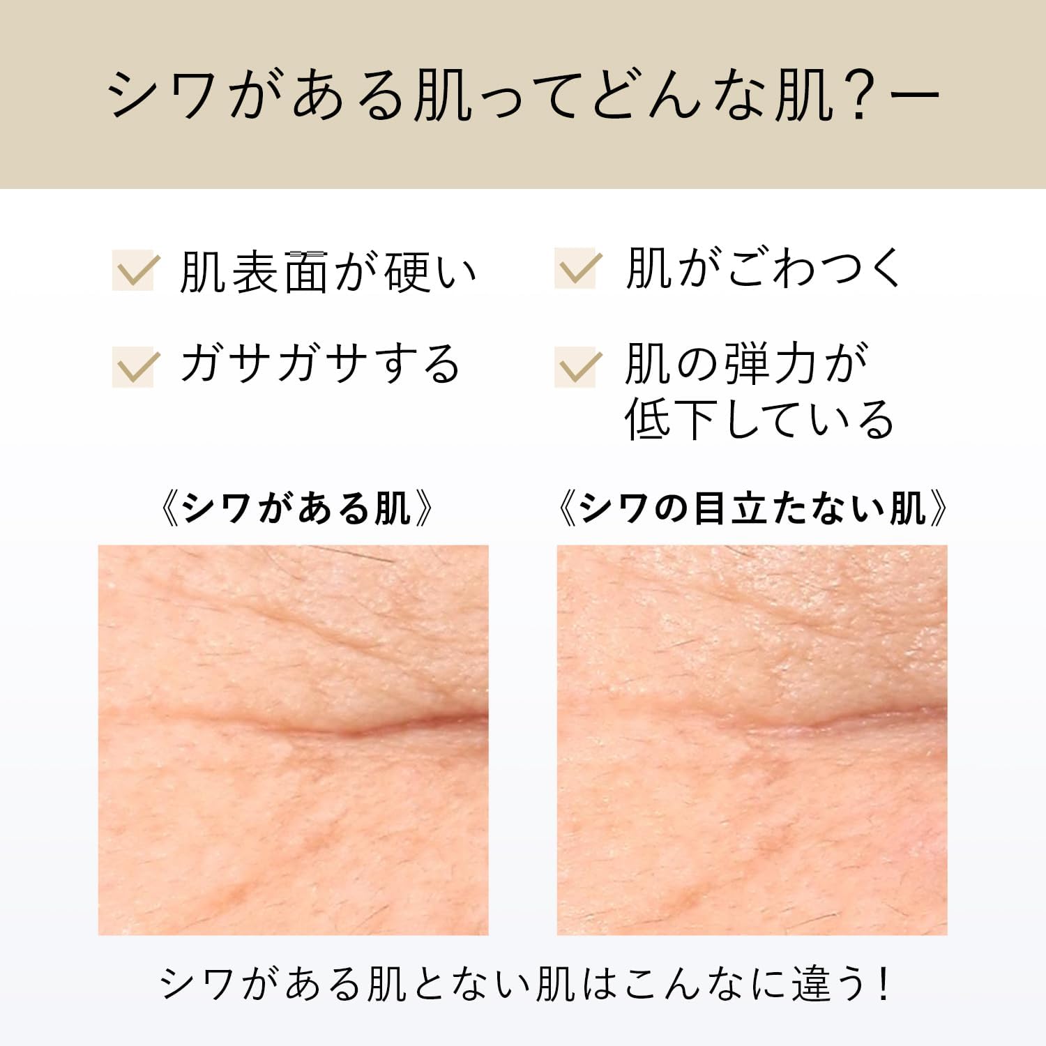 Shiseido - Elixir Retinol Power Wrinkle Cream 15gr
